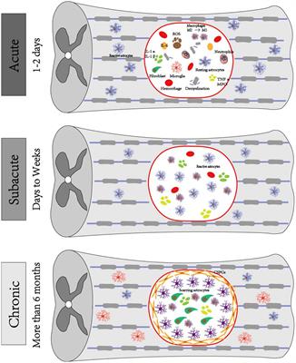 Biomaterials targeting the microenvironment for spinal cord injury repair: progression and perspectives